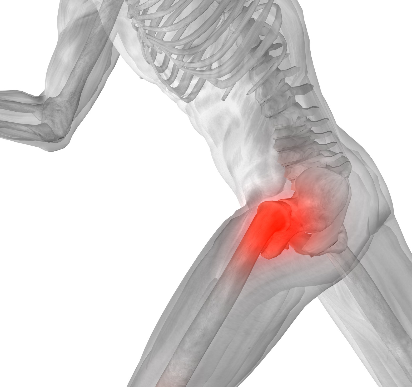 Hip Pain: How To Treat It And Why