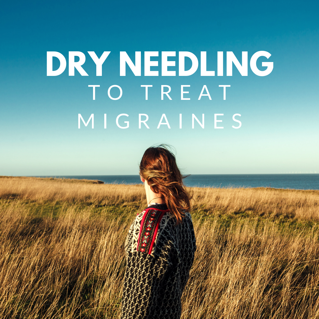 Dry Needling: Migraine Edition