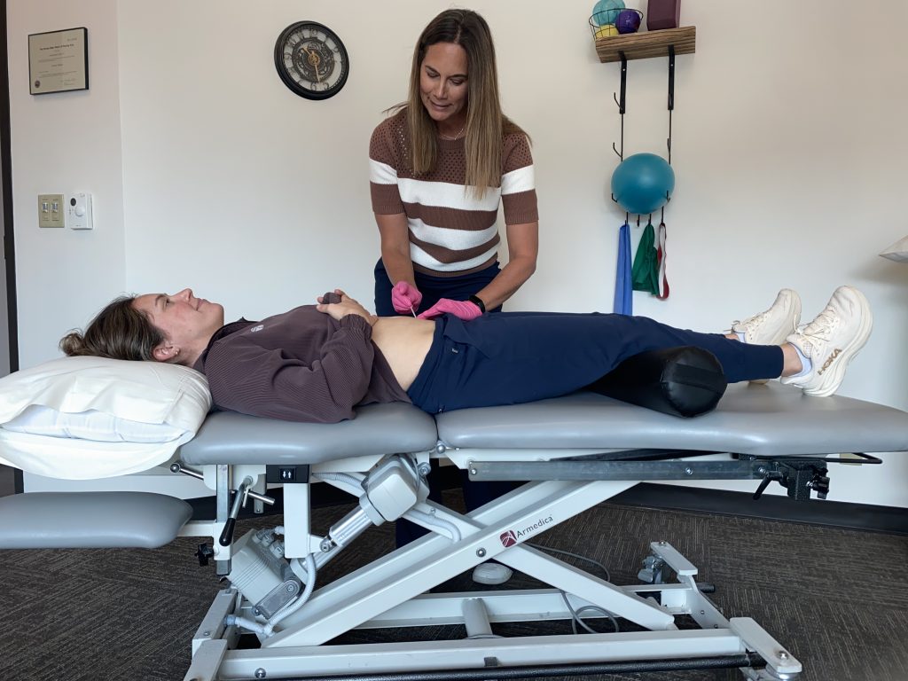 Dry Needling